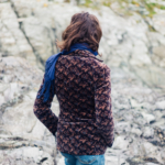 Rosacea: orsak, symtom & behandling